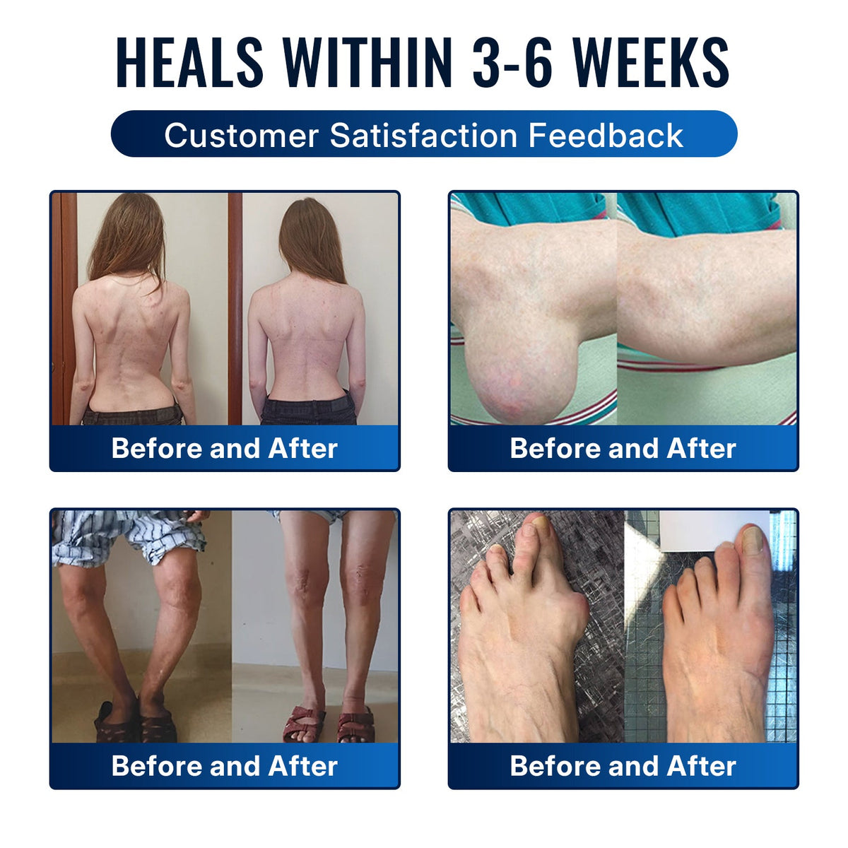 🎁Healrize® Bee Venom Joint Relief Cream 💞Fast-Acting Comfort for Stiff Knees, Hands, Back & Everyday Joint Discomfort.